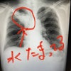 【2022年9月14日】肺炎外来の画像