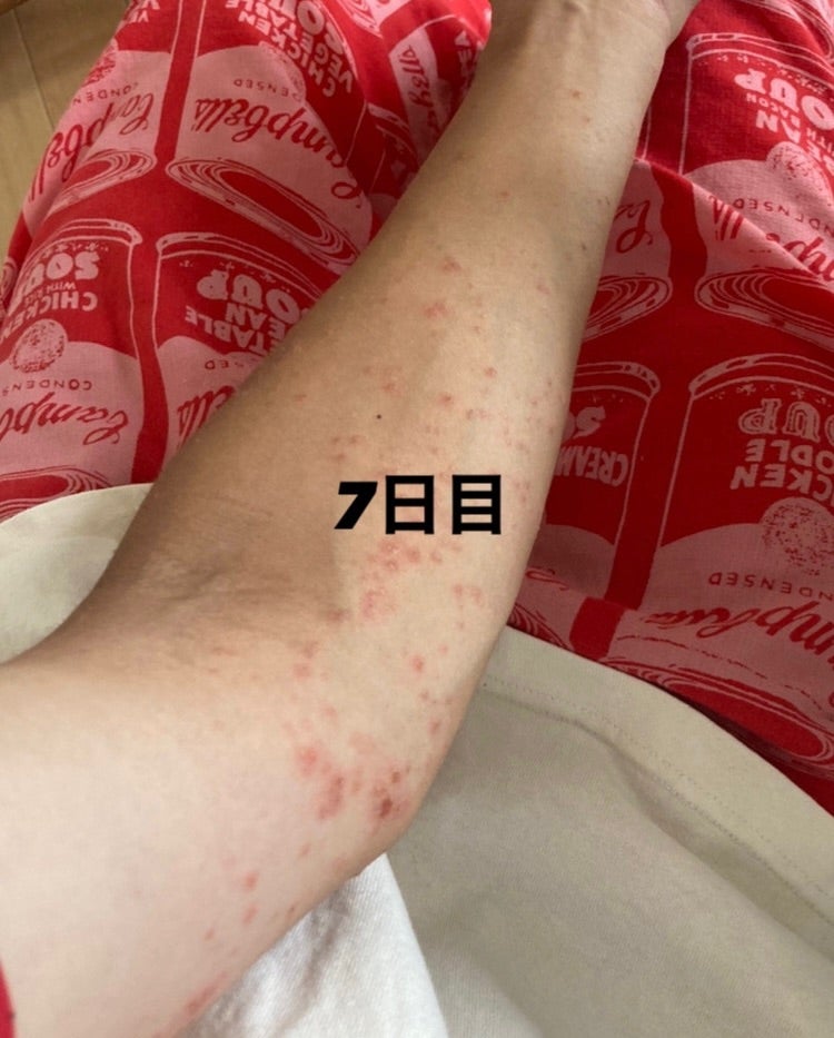 ヨドバシ.com - アトピー性皮膚炎はこわくない―アトピーが治ら