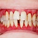 削らない歯医者のブログ