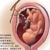 妊婦さんの６０％の胎児を襲う歯周病菌の脅威の画像