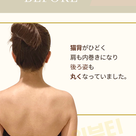 【Before after】首猫背管理・美人肩管理を受けられたお客様の記事より