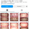 ハート歯科のインビザライン症例✨の画像