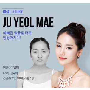 ［韓国美容整形］ブラウン整形外科でより綺麗でより自信アップのREAL STORY♡の画像