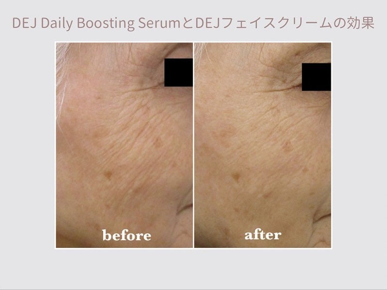 DEJ Daily Boosting SerumとDEJフェイスクリームの効果 | 福岡市 DEJ Daily Boosting SerumとDEJフェイスクリームの効果 | 福岡市