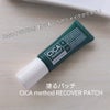 CICA method RECOVER PATCHの画像