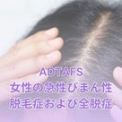 ADTAFS脱毛症の記事より