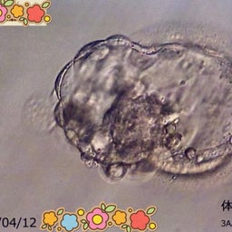 画像 2度目の凍結胚移植 の記事より