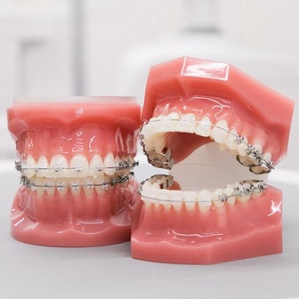 歯列矯正、早く歯を動かすためにできること