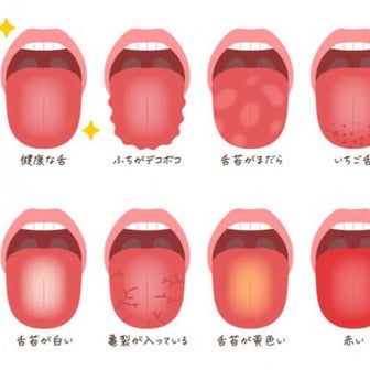 『舌』が教えてくれる身体からのサインとは？