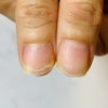ネイル イスト ☾ 多摩市 多摩センター ネイルサロン 爪の剥離の画像