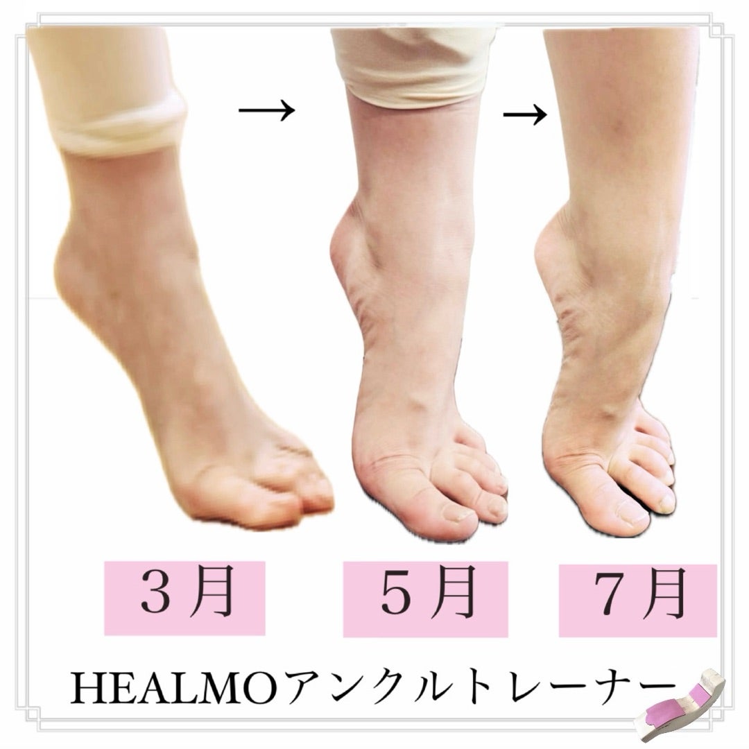 HEALMO 尽せ ヒールモ バレエ甲だし HEALMO 尽せ ヒールモ バレエ甲だし