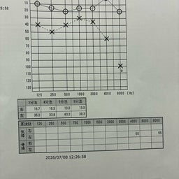 画像 聴力検査＆京大病院 耳鼻咽喉科 西村先生の診察でした。 の記事より