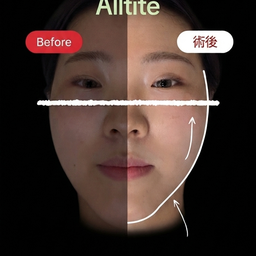 画像 インスタントで実感 できるAlltiteリフト効果 の記事より