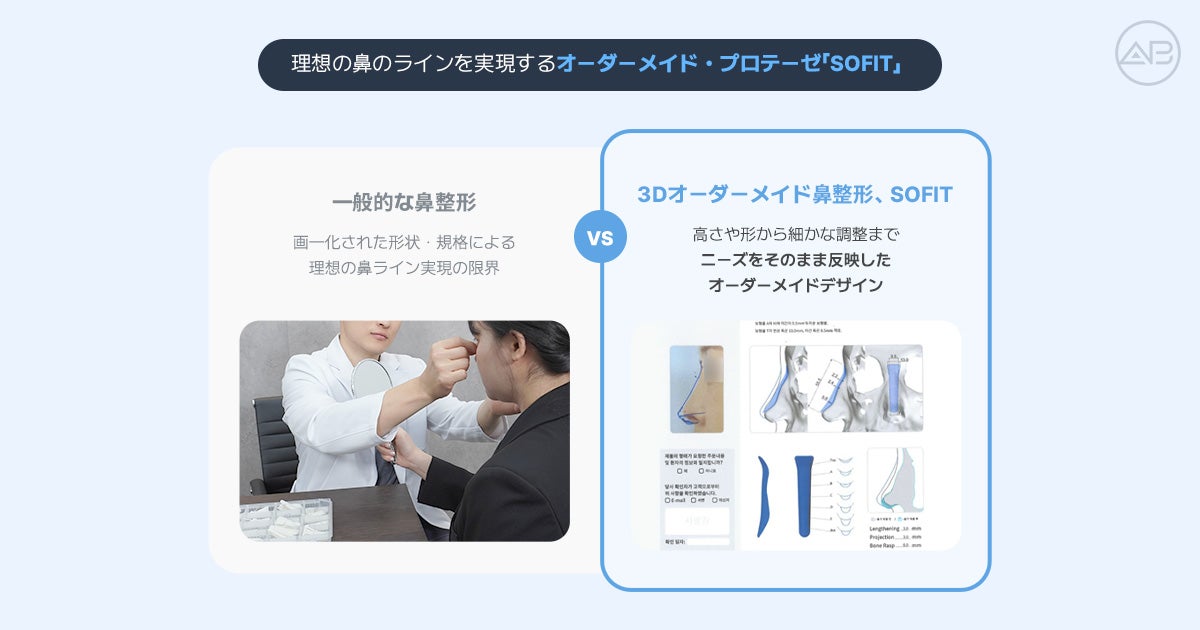 SOFIT（ソフィット）鼻整形とは？一般的なプロテーゼとの違いとオーダーメイドプロテーゼが適しての記事画像