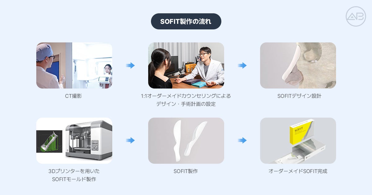 SOFIT（ソフィット）鼻整形とは？一般的なプロテーゼとの違いとオーダーメイドプロテーゼが適しての記事画像