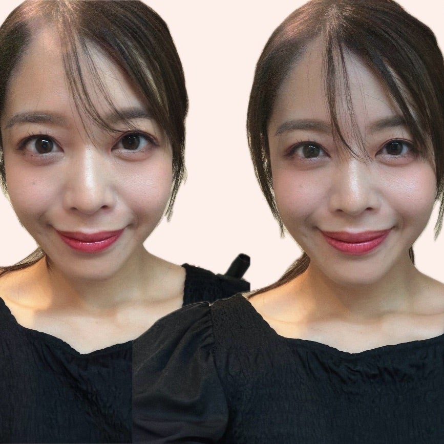 今だけ2万円OFF！笑顔をアプデするならこれ！ | ゆめちんオフィシャル