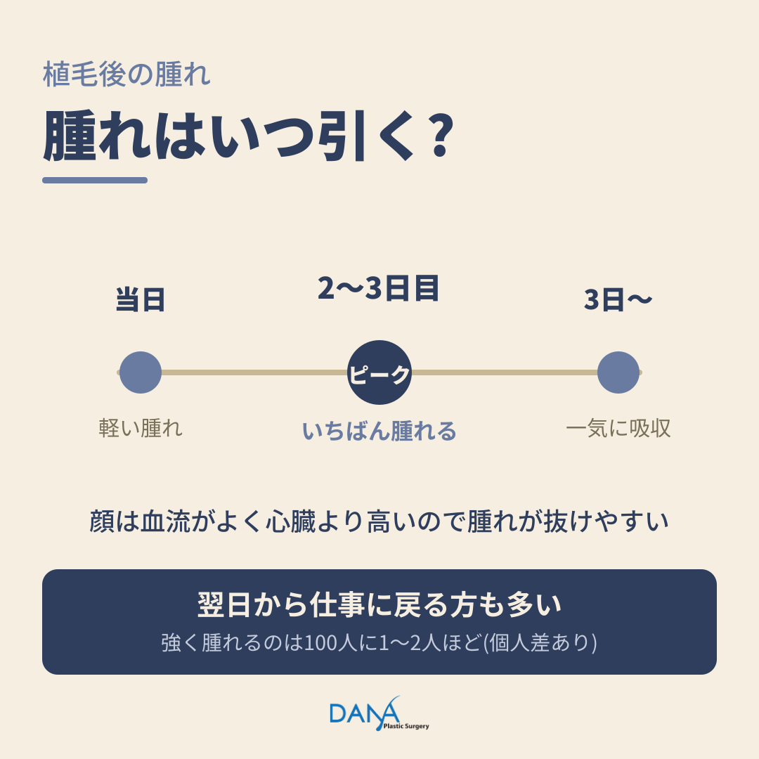 植毛した後の腫れ、心配いらない❓の記事画像
