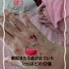 ”第20話” 夢で死ぬことは生まれ変わることの画像