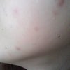 ★驚きの変化・肌★の画像
