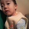栗とメロンの画像