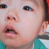 尻骨の画像