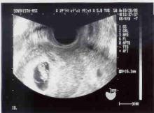 8weeks ultra sound