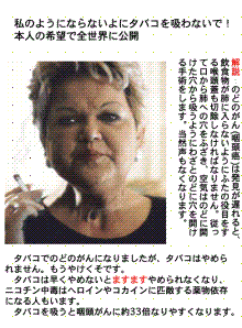 咽頭癌
