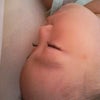 逆子の画像